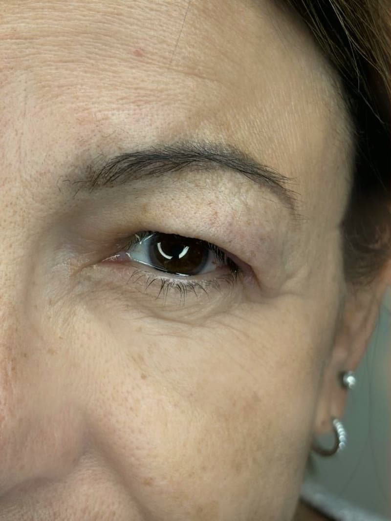Powderbrows — Vorher